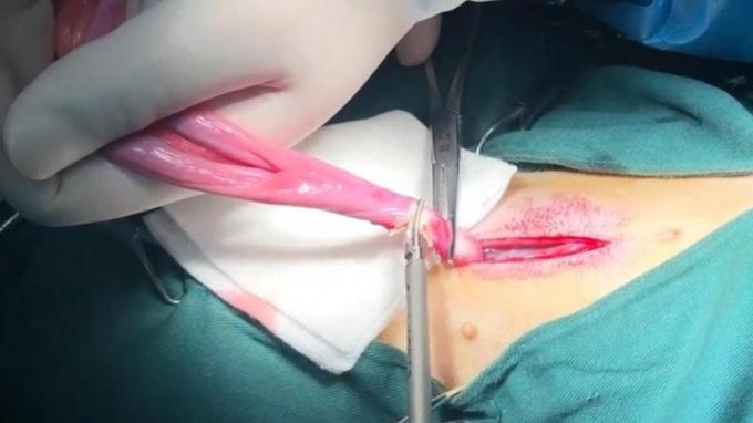 最新の会社の事例について 猫の不妊手術と去勢手術でペット用超音波メスを使用外科 0